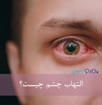 التهاب چشم